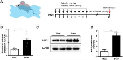 Casein Kinase-2 Interacting Protein-1 Regulates Physiological Cardiac Hypertrophy via Inhibition of Histone Deacetylase 4 Phosphorylation